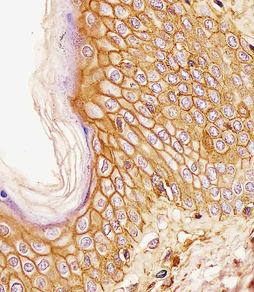 169110 staining CD44 in human skin tissue sections by Immunohistochemistry (IHC-P - paraformaldehyde-fixed, paraffin-embedded sections). Tissue was fixed with formaldehyde and blocked with 3% BSA for 0. 5 hour at room temperature; antigen retrieval was by heat mediation with a citrate buffer (pH6). Samples were incubated with primary antibody (1/25) for 1 hours at 37°C. A undiluted biotinylated goat polyvalent antibody was used as the secondary antibody.