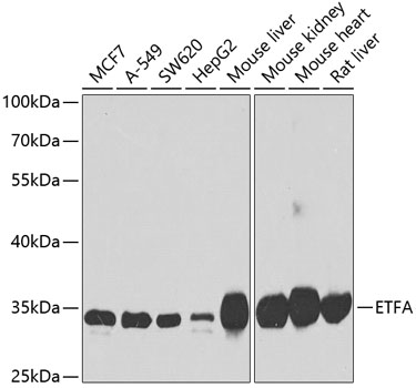 Western blot - ETFA Polyclonal Antibody 