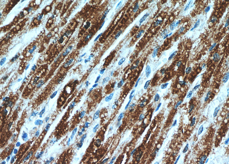 Immunohistochemical of paraffin-embedded human heart using Catalog No:108205(ART5 antibody) at dilution of 1:50 (under 40x lens)