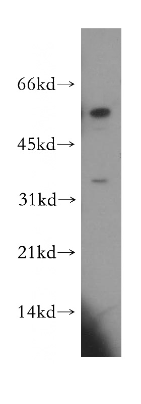 human skeletal muscle tissue were subjected to SDS PAGE followed by western blot with Catalog No:108972(CCDC28B antibody) at dilution of 1:300