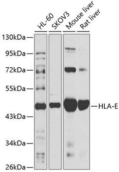 Western blot - HLA-E Polyclonal Antibody 