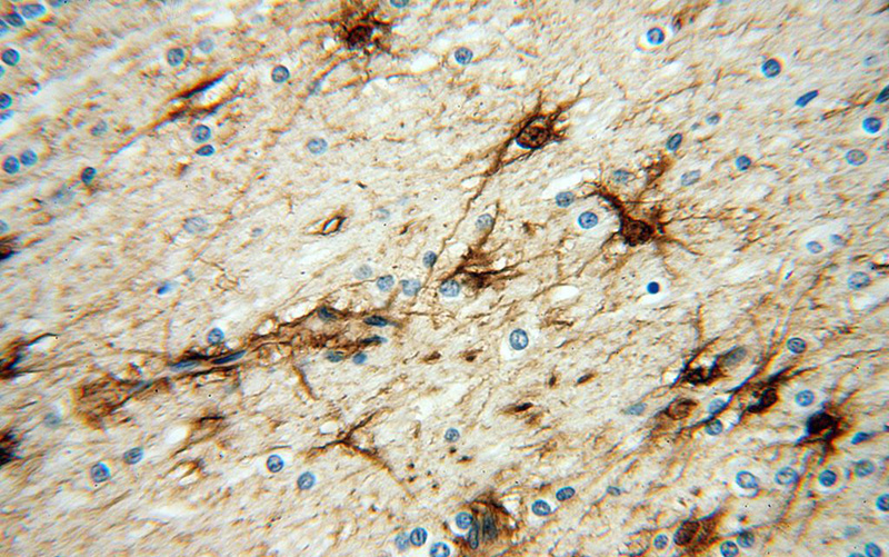 Immunohistochemical of paraffin-embedded human brain using Catalog No:110629(FGF1 antibody) at dilution of 1:50 (under 40x lens)