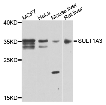 Western blot - SULT1A3 Polyclonal Antibody 