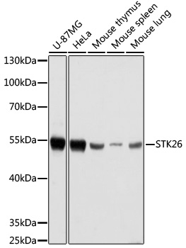 Western blot - STK26 Polyclonal Antibody 