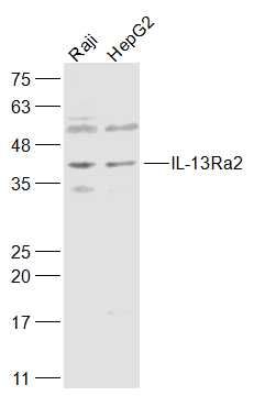 Fig2: Sample:; Raji(Human) Cell Lysate at 30 ug; HepG2(Human) Cell Lysate at 30 ug; Primary: Anti-IL-13Ra2 at 1/1000 dilution; Secondary: IRDye800CW Goat Anti-Rabbit IgG at 1/20000 dilution; Predicted band size: 41 kD; Observed band size: 41 kD