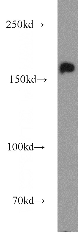 BxPC-3 cells were subjected to SDS PAGE followed by western blot with Catalog No:108065(ANKRD11 antibody) at dilution of 1:500
