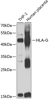 Western blot - HLA-G Polyclonal Antibody 