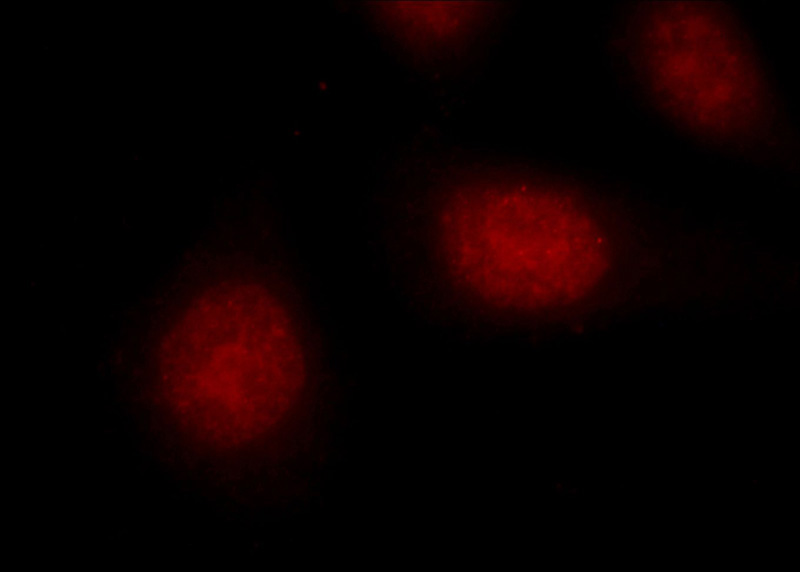 Immunofluorescent analysis of HeLa cells using Catalog No:110220(EGR1 Antibody) at dilution of 1:25 and Rhodamine-Goat anti-Rabbit IgG