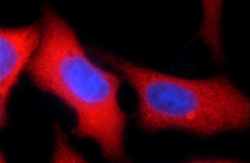 Immunofluorescent analysis of HepG2 cells using Catalog No:116880(YAP1 Antibody) at dilution of 1:50 and Rhodamine-Goat anti-Rabbit IgG