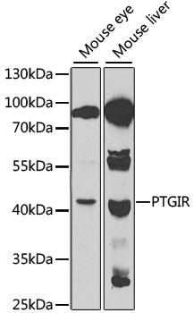Western blot - PTGIR Polyclonal Antibody 