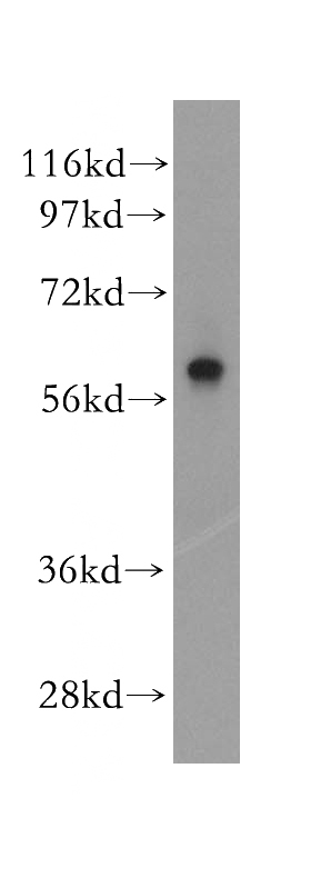 human kidney tissue were subjected to SDS PAGE followed by western blot with Catalog No:113594(PARP3 antibody) at dilution of 1:500