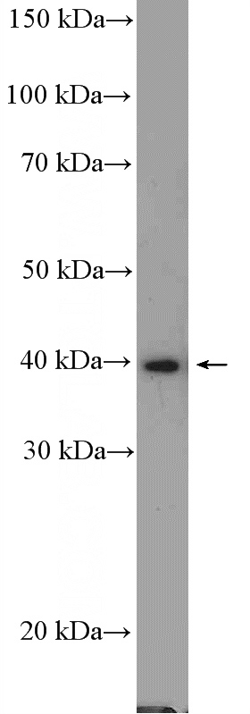 A549 cells were subjected to SDS PAGE followed by western blot with Catalog No:114205(PRMT1 Antibody) at dilution of 1:600