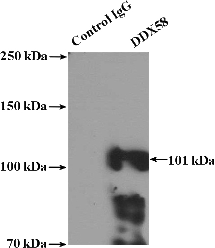 IP Result of anti-DDX58 (IP:Catalog No:109841, 4ug; Detection:Catalog No:109841 1:600) with A431 cells lysate 1200ug.