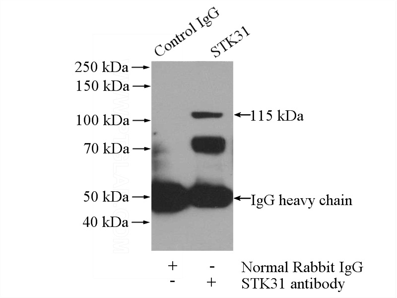 IP Result of anti-STK31 (IP:Catalog No:115716, 4ug; Detection:Catalog No:115716 1:1000) with mouse testis tissue lysate 2400ug.