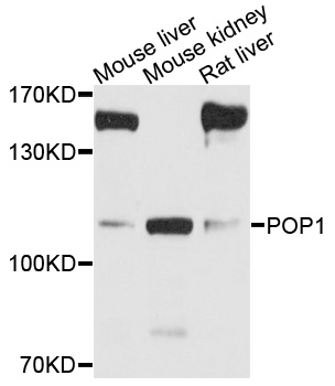 Western blot - POP1 Polyclonal Antibody 