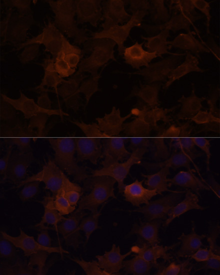 Immunofluorescence - FLNB Polyclonal Antibody 