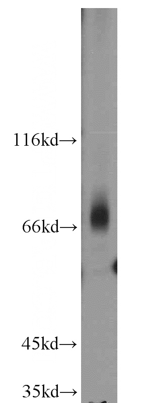 Jurkat cells were subjected to SDS PAGE followed by western blot with Catalog No:109128(CD5 antibody) at dilution of 1:500
