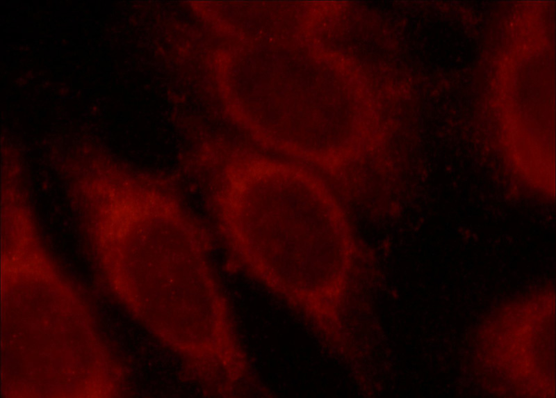Immunofluorescent analysis of HepG2 cells, using MLYCD antibody Catalog No:112689 at 1:50 dilution and Rhodamine-labeled goat anti-rabbit IgG (red).