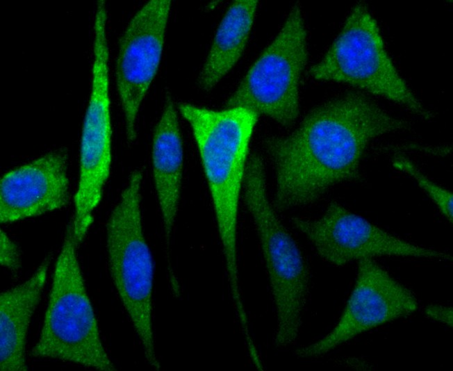 Fig2: ICC staining CACNG3 in SH-SY-5Y cells (green). The nuclear counter stain is DAPI (blue). Cells were fixed in paraformaldehyde, permeabilised with 0.25% Triton X100/PBS.