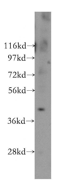 A375 cells were subjected to SDS PAGE followed by western blot with Catalog No:113099(NEIL1 antibody) at dilution of 1:300