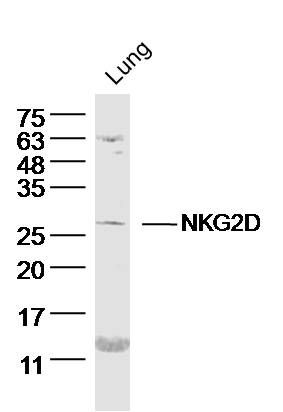 Fig2: Sample: Lung (Mouse) Lysate at 40 ug; Primary: Anti- NKG2D at 1/300 dilution; Secondary: IRDye800CW Goat Anti-Rabbit IgG at 1/20000 dilution; Predicted band size: 25 kD; Observed band size: 26 kD
