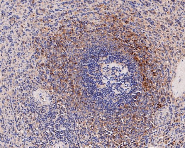 Fig4:; Immunohistochemical analysis of paraffin-embedded human spleen tissue using anti-IL18 binding protein antibody. The section was pre-treated using heat mediated antigen retrieval with Tris-EDTA buffer (pH 8.0-8.4) for 20 minutes.The tissues were blocked in 5% BSA for 30 minutes at room temperature, washed with ddH; 2; O and PBS, and then probed with the primary antibody ( 1/50) for 30 minutes at room temperature. The detection was performed using an HRP conjugated compact polymer system. DAB was used as the chromogen. Tissues were counterstained with hematoxylin and mounted with DPX.