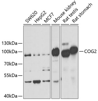 Western blot - COG2 Polyclonal Antibody 
