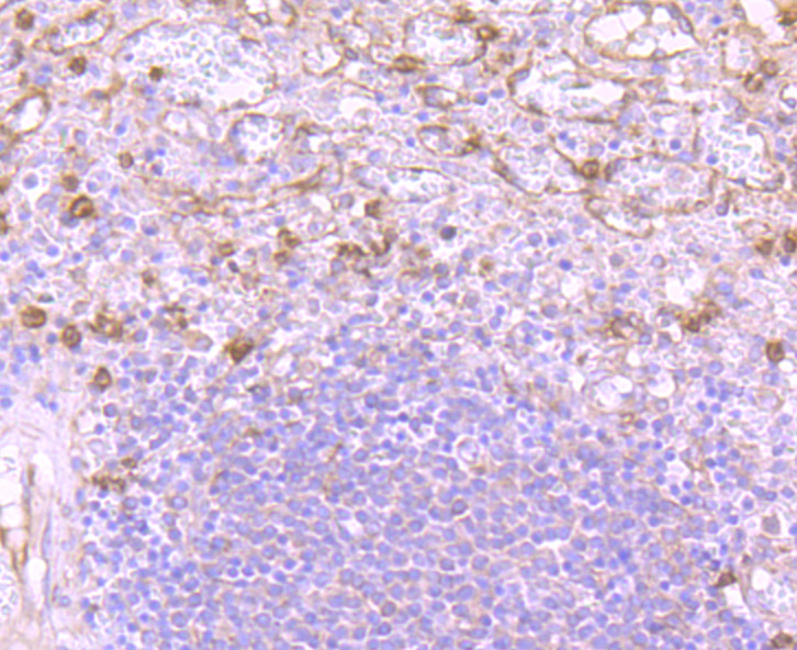 Fig2:; Immunohistochemical analysis of paraffin-embedded human spleen tissue using anti-Versican antibody. The section was pre-treated using heat mediated antigen retrieval with Tris-EDTA buffer (pH 8.0-8.4) for 20 minutes.The tissues were blocked in 5% BSA for 30 minutes at room temperature, washed with ddH; 2; O and PBS, and then probed with the primary antibody ( 1/50) for 30 minutes at room temperature. The detection was performed using an HRP conjugated compact polymer system. DAB was used as the chromogen. Tissues were counterstained with hematoxylin and mounted with DPX.