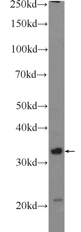 COLO 320 cells were subjected to SDS PAGE followed by western blot with Catalog No:109340(CLDN23 Antibody) at dilution of 1:600