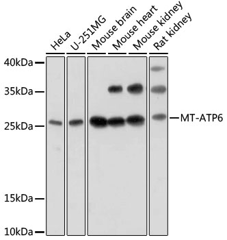 Western blot - MT-ATP6 Polyclonal Antibody 