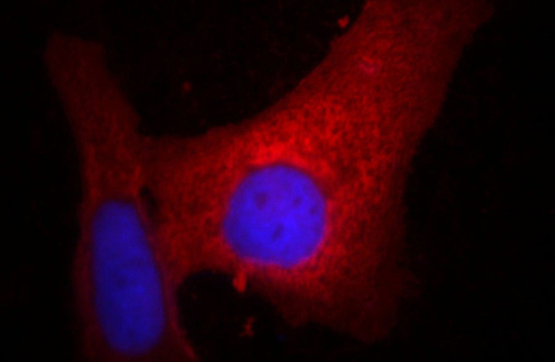 Immunofluorescent analysis of Hela cells, using HSP90B1 antibody Catalog No: at 1:25 dilution and Rhodamine-labeled goat anti-mouse IgG (red). Blue pseudocolor = DAPI (fluorescent DNA dye).