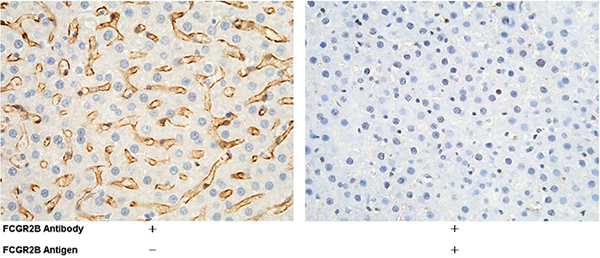 CD32b / Fc gamma RIIB / FCGR2B Antibody, Rabbit PAb, Antigen Affinity Purified, Immunohistochemistry