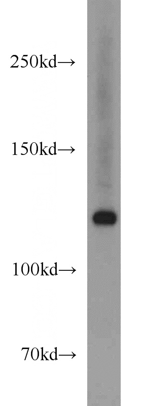 Jurkat cells were subjected to SDS PAGE followed by western blot with Catalog No:110499(EXO1 antibody) at dilution of 1:800