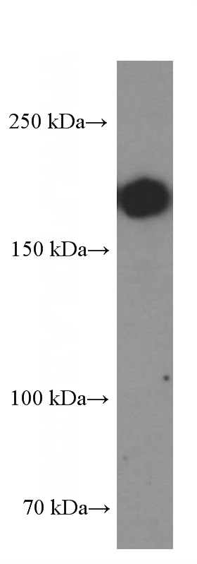 pig spleen tissue were subjected to SDS PAGE followed by western blot with Catalog No:107137(CD45 Antibody) at dilution of 1:2000