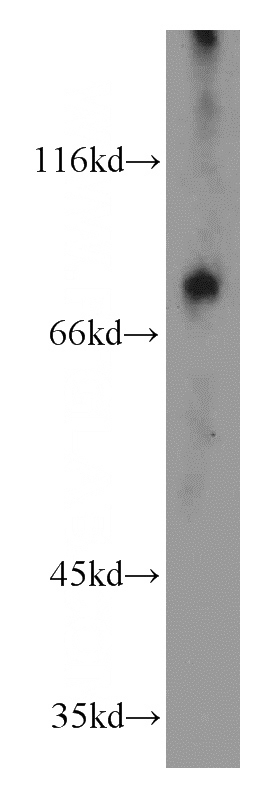 mouse small intestine tissue were subjected to SDS PAGE followed by western blot with Catalog No:113320(SLC22A5 antibody) at dilution of 1:500