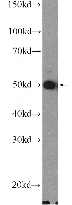HepG2 cells were subjected to SDS PAGE followed by western blot with Catalog No:108417(SLC4A1 Antibody) at dilution of 1:300