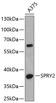 Western blot - SPRY2 Polyclonal Antibody 