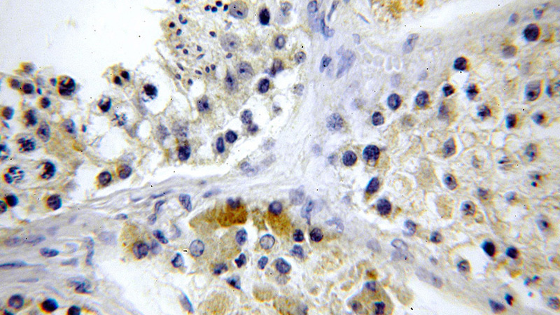 Immunohistochemical of paraffin-embedded human testis using Catalog No:112348(LSM14A antibody) at dilution of 1:100 (under 40x lens)