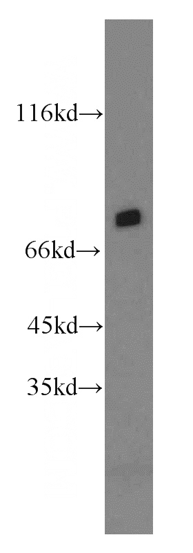 mouse brain tissue were subjected to SDS PAGE followed by western blot with Catalog No:114225(PROX1 antibody) at dilution of 1:500