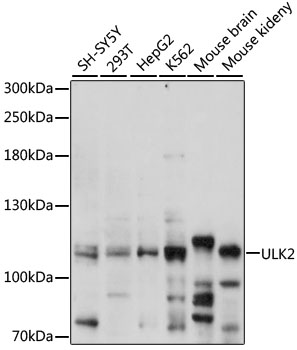 Western blot - ULK2 Polyclonal Antibody 