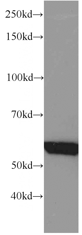mouse skeletal muscle tissue were subjected to SDS PAGE followed by western blot with Catalog No:107293(GEFT antibody) at dilution of 1:1000