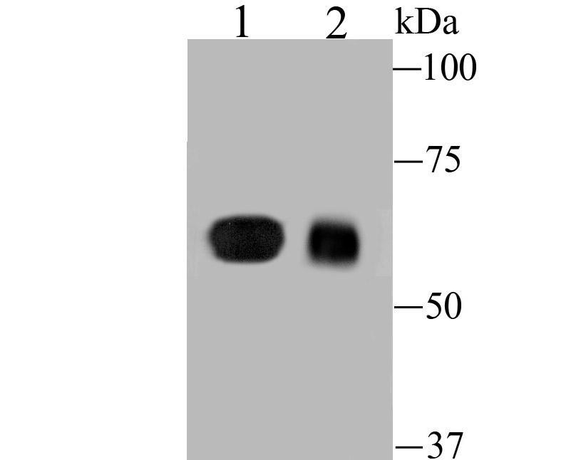 Fig1:; Western blot analysis of DLL4 on different lysates. Proteins were transferred to a PVDF membrane and blocked with 5% BSA in PBS for 1 hour at room temperature. The primary antibody ( 1/500) was used in 5% BSA at room temperature for 2 hours. Goat Anti-Rabbit IgG - HRP Secondary Antibody (HA1001) at 1:5,000 dilution was used for 1 hour at room temperature.; Positive control:; Lane 1: 293 cell lysate; Lane 2: Mouse placenta tissue lysate