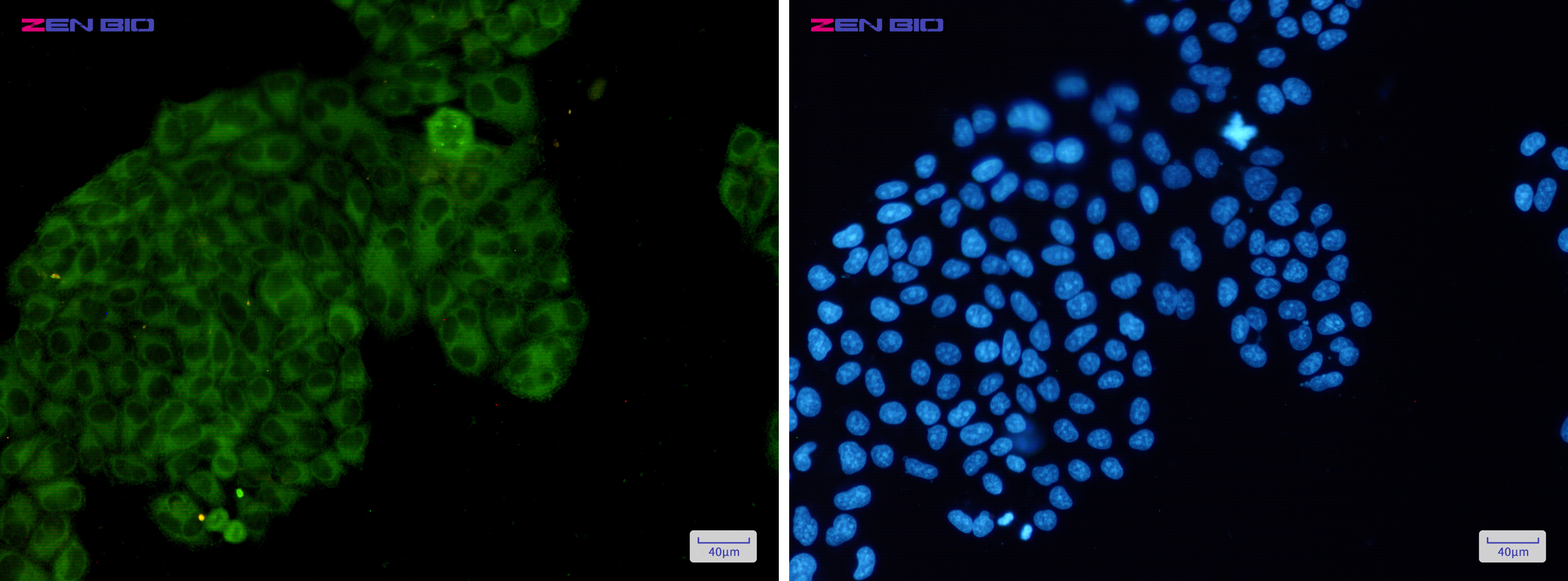 Immunocytochemistry of PAK1 (Phospho-Ser144)/PAK2 (Phospho-Ser141)/PAK3 (Phospho-Ser154)(green) in Hela cells using PAK1 (Phospho-Ser144)/PAK2 (Phospho-Ser141)/PAK3 (Phospho-Ser154) Rabbit pAb at dilution 1/50, and DAPI(blue)