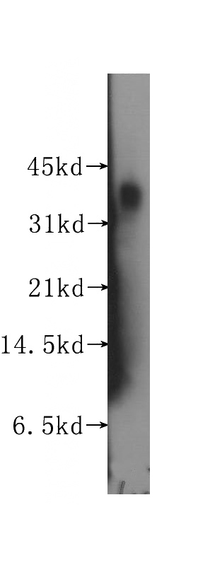 human heart tissue were subjected to SDS PAGE followed by western blot with Catalog No:110000(DLX4 antibody) at dilution of 1:500