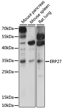 Western blot - ERP27 Polyclonal Antibody 