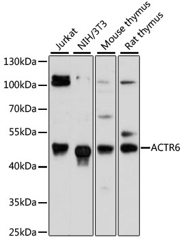 Western blot - ACTR6 Polyclonal Antibody 