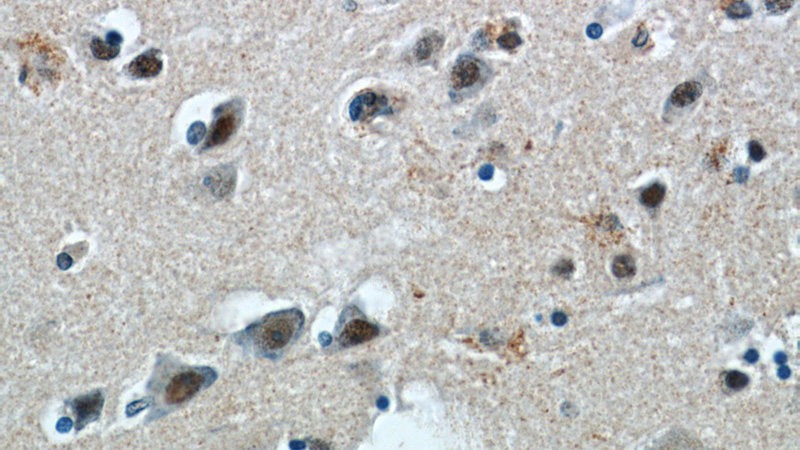 Immunohistochemical of paraffin-embedded human brain using Catalog No:108682(C1orf83 antibody) at dilution of 1:50 (under 40x lens)