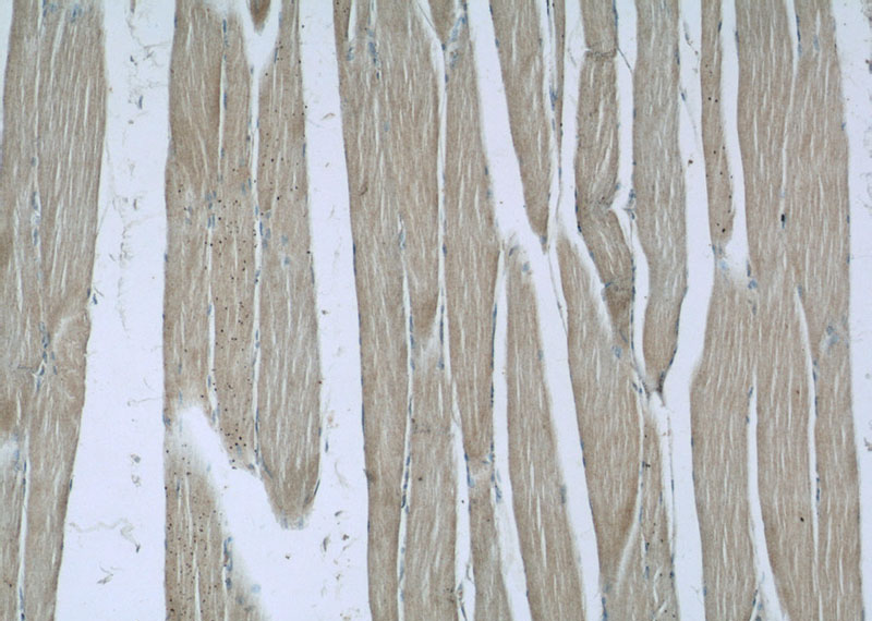 Immunohistochemistry of paraffin-embedded human skeletal muscle slide using Catalog No:108664(C14orf39 Antibody) at dilution of 1:50