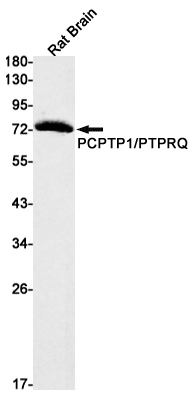 Western blot detection of PCPTP1/PTPRQ in Rat Brain lysates using PCPTP1/PTPRQ Rabbit mAb(1:1000 diluted).Predicted band size:74kDa.Observed band size:74kDa.
