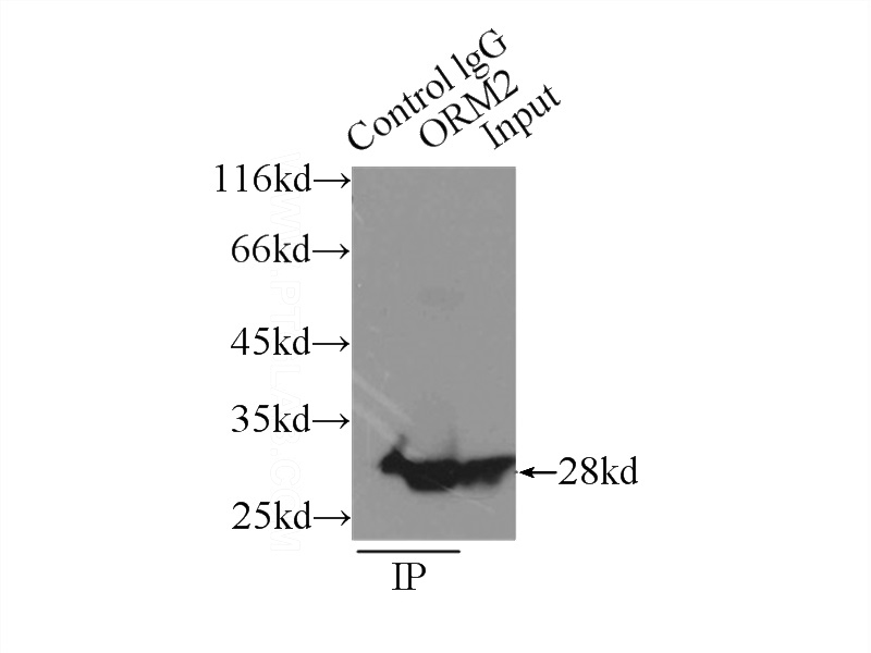 IP Result of anti-ORM2 (IP:Catalog No:113426, 3ug; Detection:Catalog No:113426 1:800) with L02 cells lysate 2500ug.